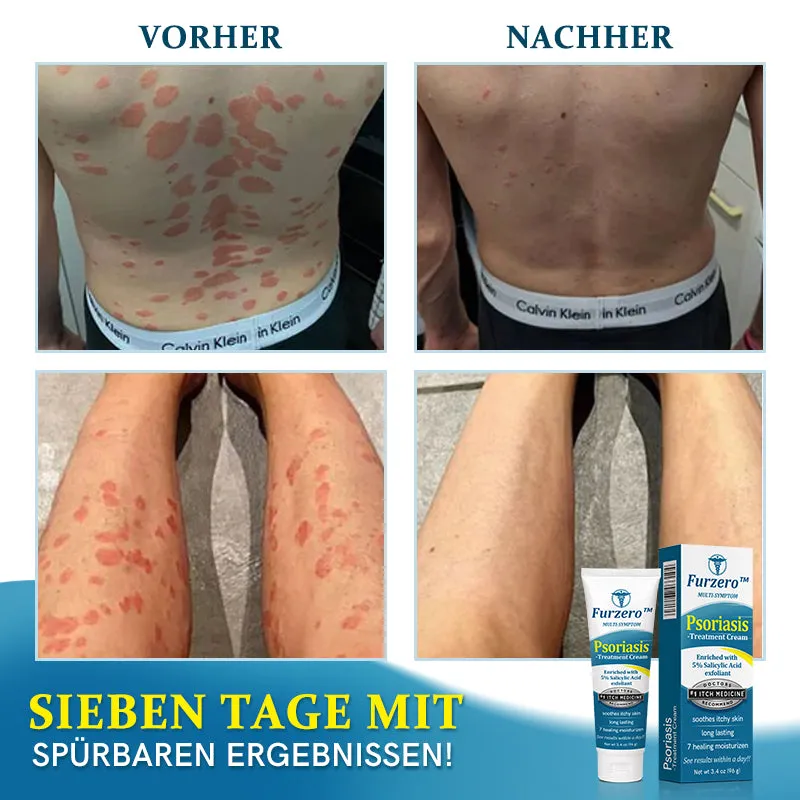 Furzero Multi-Symptom Psoriasis Behandlungscreme