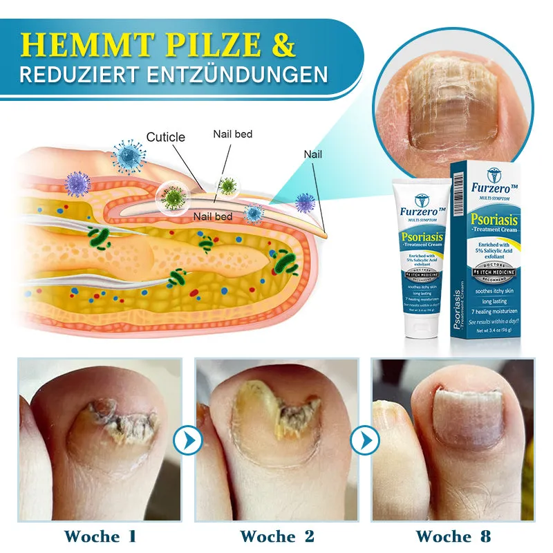 Furzero Multi-Symptom Psoriasis Behandlungscreme