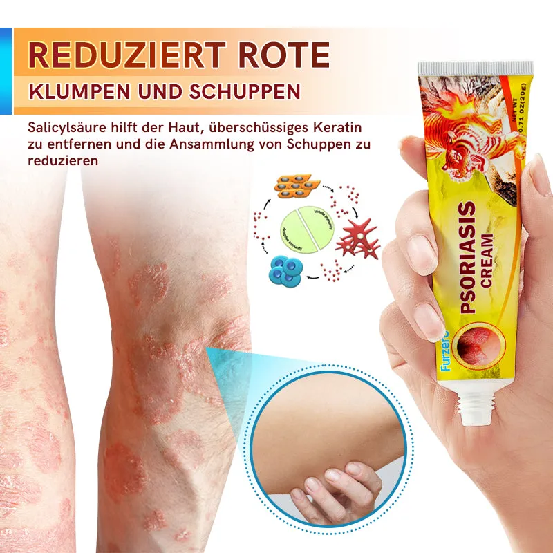 Furzero PsoriaCare Psoriasis-Behandlungscreme