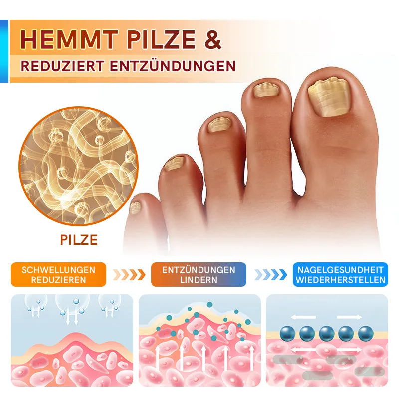 Furzero PsoriaCare Psoriasis-Behandlungscreme