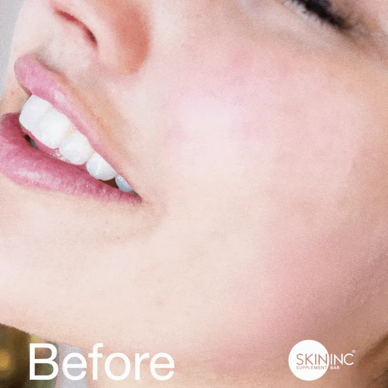 Serum Glow Filter